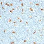 Formalin-fixed, paraffin embedded human tonsil sections stained with 100 ul anti-S100A9 (clone S100A9/1011) at 1:300. HIER epitope retrieval prior to staining was performed in 10mM Citrate, pH 6.0.